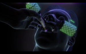 仙台市宮城野区のしらとり歯科医院によるインプラント手術アシスト機器のイメージ。最新のナビゲーションシステムとトラッキング技術を活用した精密な治療。