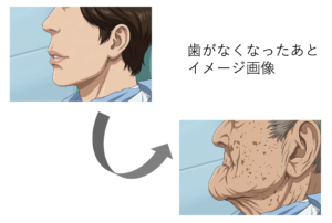 仙台市宮城野区の歯科医院が解説する、歯を失った後の顔貌の変化と骨の萎縮。インプラント治療による顎の骨の健康維持の重要性。