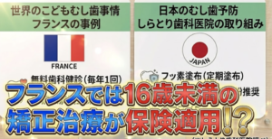 日本とフランスのむし歯予防・矯正治療の違いを比較した図。「フランスでは16歳未満の矯正治療が保険適用」というトピックを強調したテレビ番組風の解説。