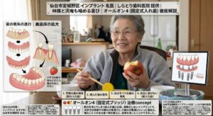 仙台市宮城野区のしらとり歯科医院でインプラント治療・オールオン4を行った祖母の体験談。総入れ歯のガタつきや痛みから解放され、大好きな林檎を丸かじりし、大根の沢庵漬け（たくあん）などの固い食べ物を笑顔でしっかり噛みしめて食事を楽しむ様子。精密3D診断に基づき総入れ歯を回避したおすすめのインプラント治療成果。 
