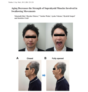 戸原玄教授らの論文「加齢と舌骨上筋群・開口力」の臨床比較画像｜仙台市宮城野区 しらとり歯科医院