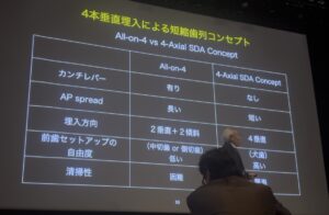 All-on-4と4本垂直埋入による短縮歯列コンセプト(4-Axial SDA)の比較表スライド|仙台市宮城野区しらとり歯科医院